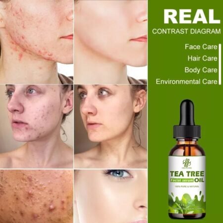Tree Oil Facial Serum 10ml