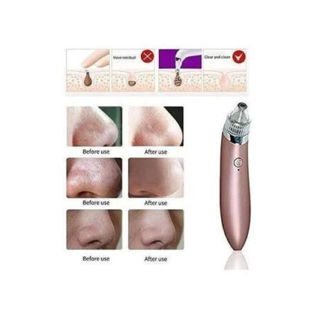 5in1 Rechargeable Black Head Remover Derma Vacuum Suction